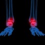 Problèmes inflammatoires et articulaires mode d’emploi