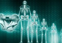 Soulager la spondylarthrite ankylosante