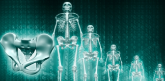 Soulager la spondylarthrite ankylosante