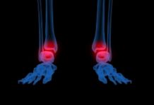 Problèmes inflammatoires et articulaires mode d’emploi douleurs inflammatoires