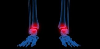 Problèmes inflammatoires et articulaires mode d’emploi douleurs inflammatoires