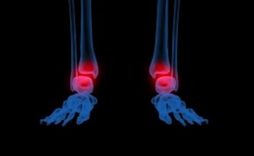 Problèmes inflammatoires et articulaires mode d’emploi douleurs inflammatoires