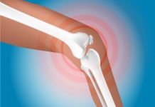 Trois compléments pour les articulations anti-inflammatoires naturels : les compléments nutritionnels pour soigner les rhumatismes