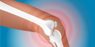 Trois compléments pour les articulations anti-inflammatoires naturels : les compléments nutritionnels pour soigner les rhumatismes