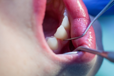 dentistes holistiques : une approche globale de l'individu pour soigner les dents