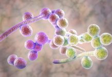 Du Candida à la candidose, mise à jour d’une maladie de civilisation du candida à la candidose : les remèdes naturels