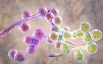 Du Candida à la candidose, mise à jour d’une maladie de civilisation du candida à la candidose : les remèdes naturels