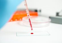 Les tests préventifs des médecines naturelles tests sanguins médecines naturelles