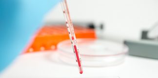 Les tests préventifs des médecines naturelles tests sanguins médecines naturelles