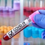 Les CD4 – CD8, ou lymphocytes T, efficaces contre les variants du Covid-19 CD4-CD8-lymphocytes-T-efficaces-contre-variants-du-Covid-19