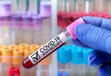 Les CD4 – CD8, ou lymphocytes T, efficaces contre les variants du Covid-19 CD4-CD8-lymphocytes-T-efficaces-contre-variants-du-Covid-19