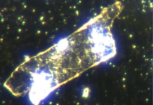 Le nouveau scandale de la viande contaminée Boeuf-biologique-Microscopie-fond-noir
