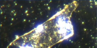 Le nouveau scandale de la viande contaminée Boeuf-biologique-Microscopie-fond-noir