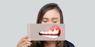 Les interactions de la parodontite avec la santé globale Parodontite-Reponses-Bio