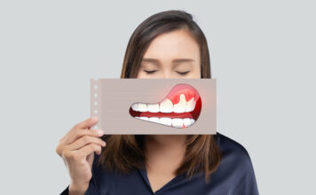 Les interactions de la parodontite avec la santé globale Parodontite-Reponses-Bio