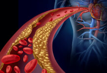 Le Charbon Ultra Activé : Votre arme naturelle contre cholestérol et hypercholestérolémie Charbon ultra activé et cholestérol