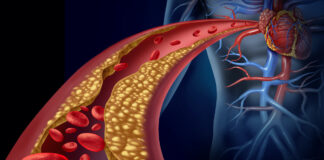 Le Charbon Ultra Activé : Votre arme naturelle contre cholestérol et hypercholestérolémie Charbon ultra activé et cholestérol